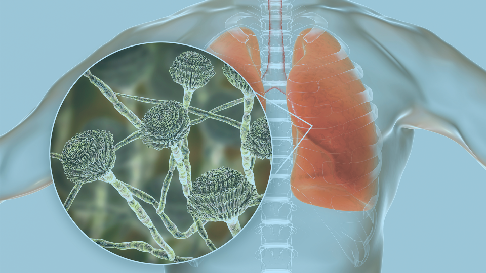 4 things clinicians need to know about mycotoxins